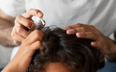 Co na wypadanie włosów znajdziesz w aptece?