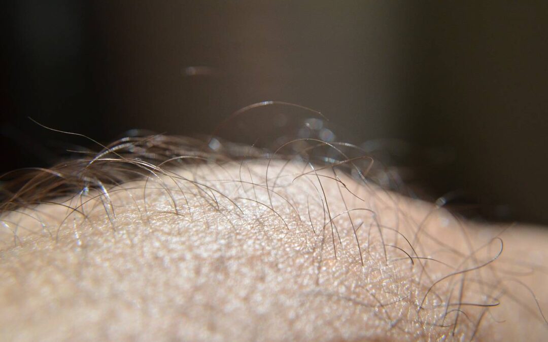 Jakie witaminy na włosy skórę i paznokcie warto wybrać?